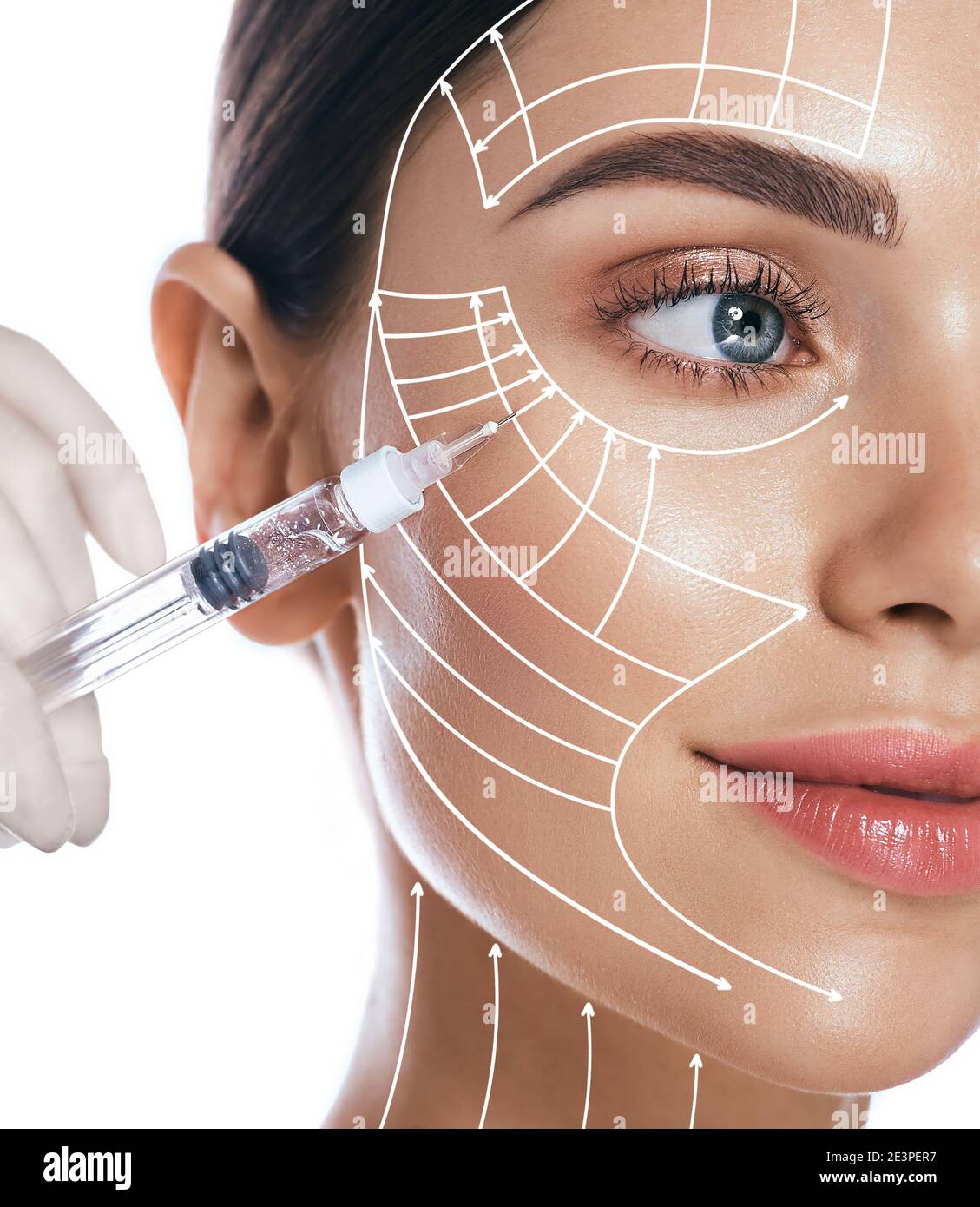 beauty injections, lifting lines on a woman's face, advertising of skin tightening. Injections in the eye area, nasolabial folds, forehead Stock Photo