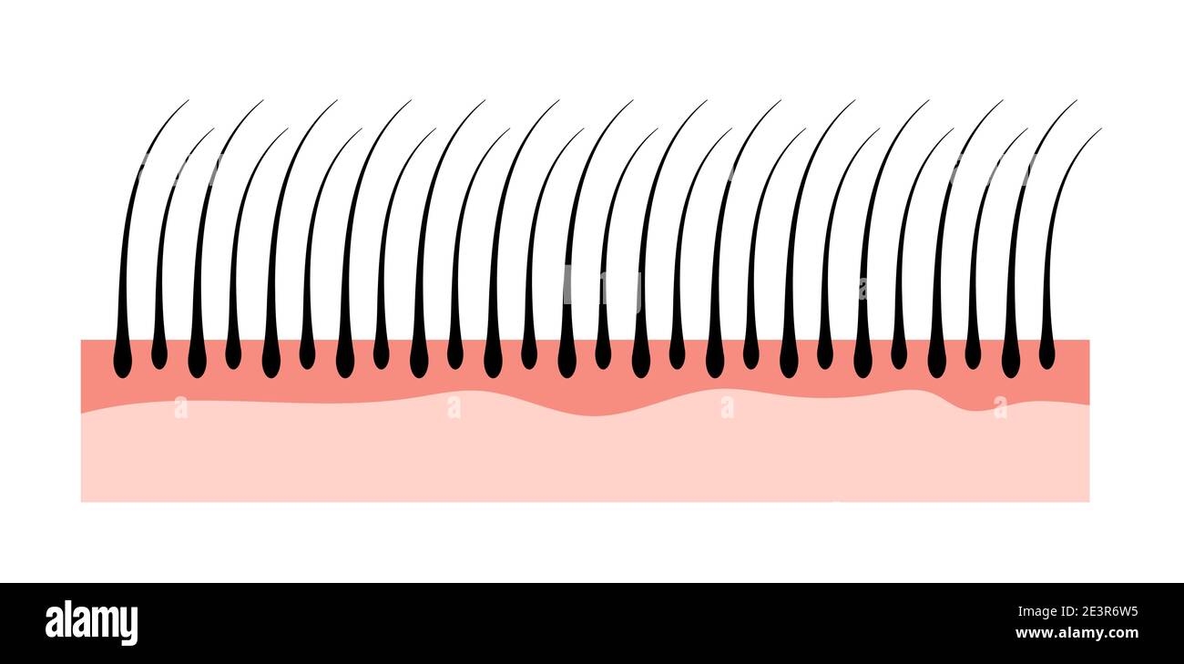 Human hair skin structure growth epidermis. Hair anatomy concept Stock