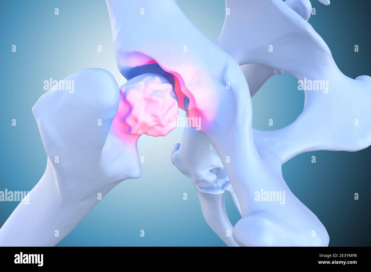 Image showcasing Canine Arthritis and Osteoarthritis joint inflammation, deterioration ...