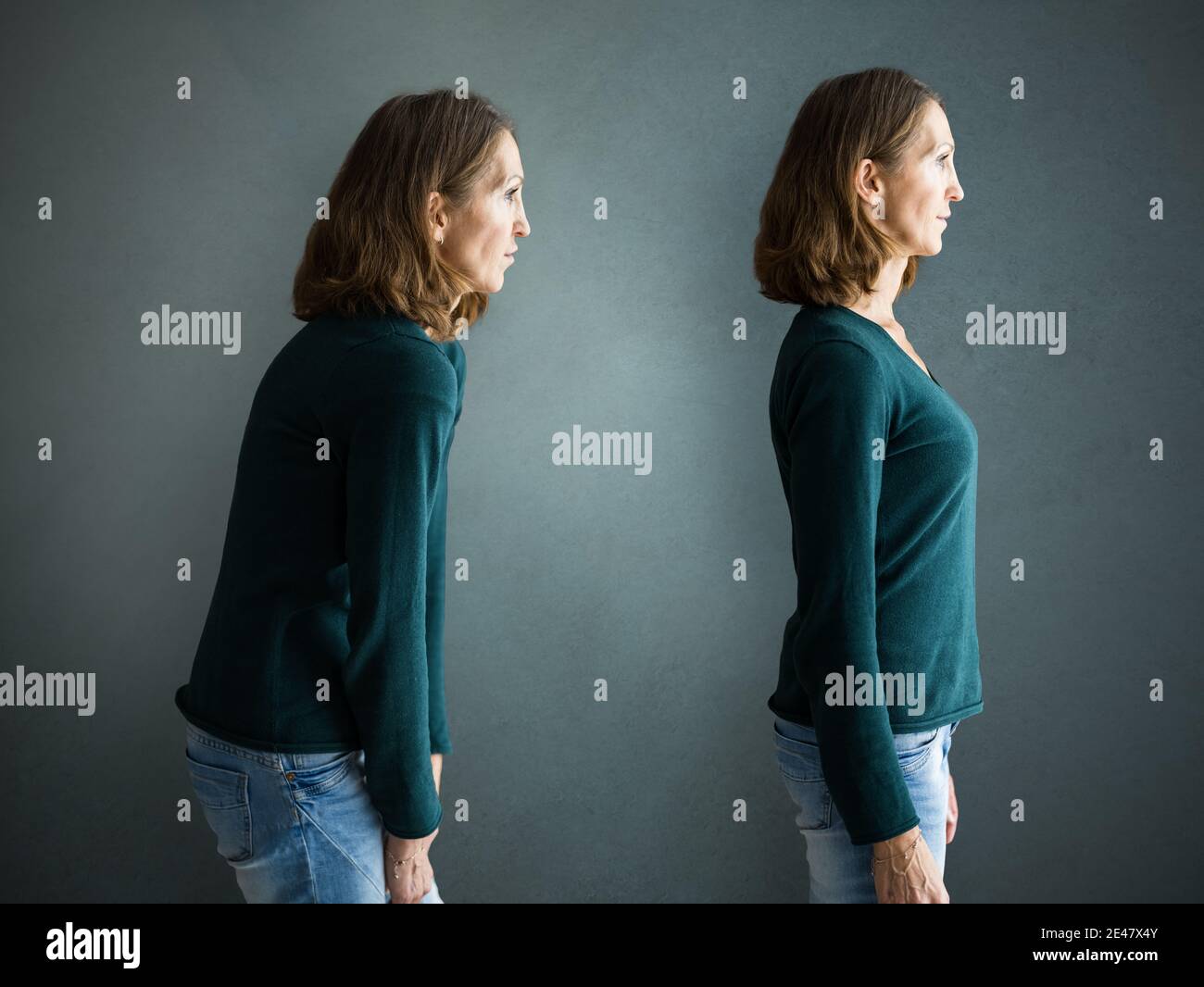 Before And After Slim Body Back Pain Posture Training Stock Photo
