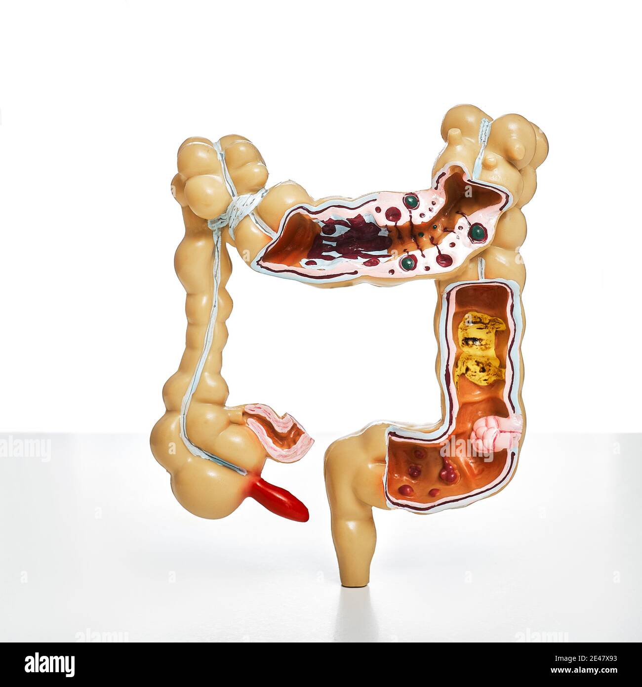 Colon model with pathologies, and different diseases, close-up for medical and biological education Stock Photo