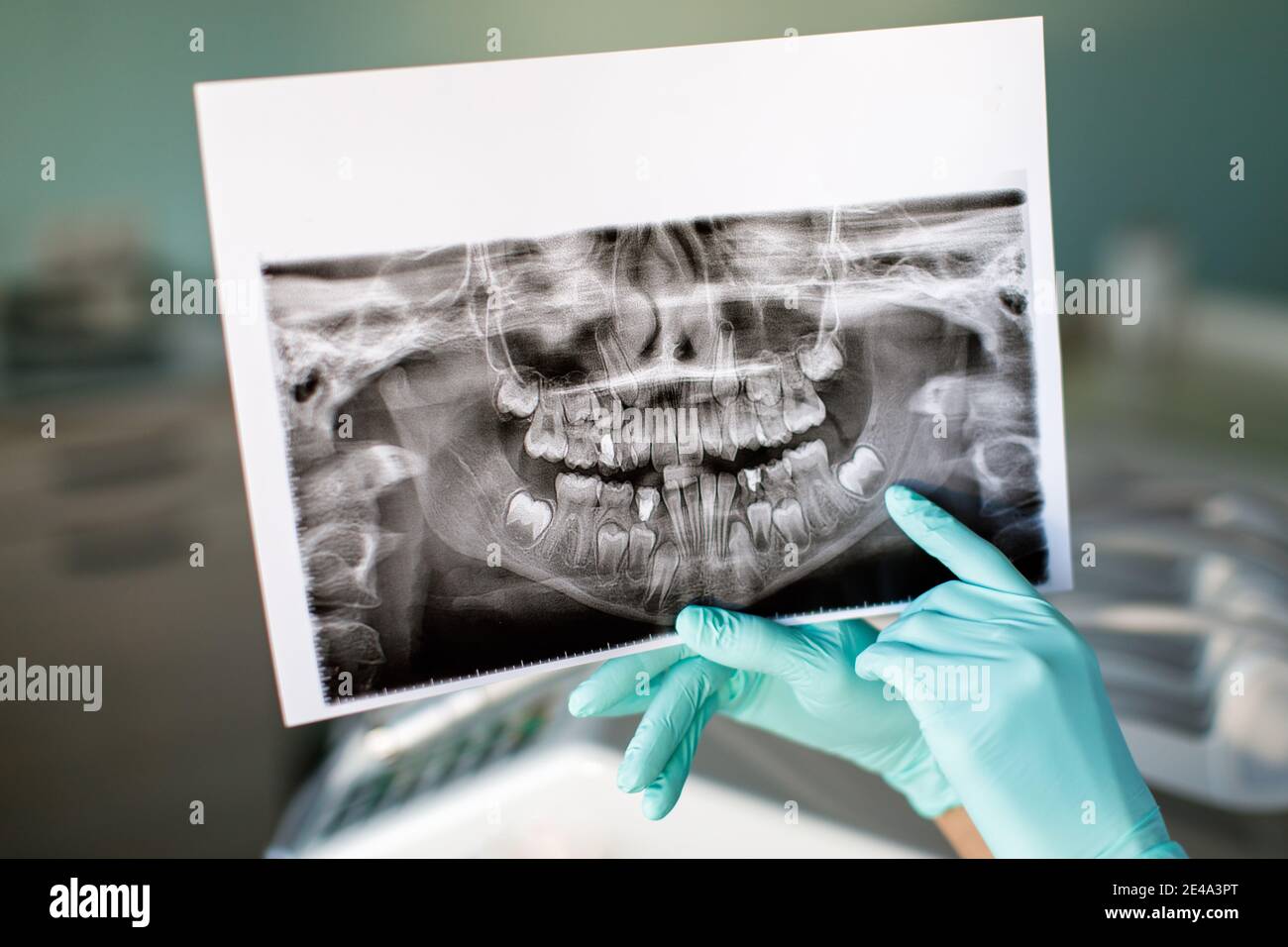 Close up woman dentist holding patient mouth digital film.Female doctor showing patient oral scan Stock Photo