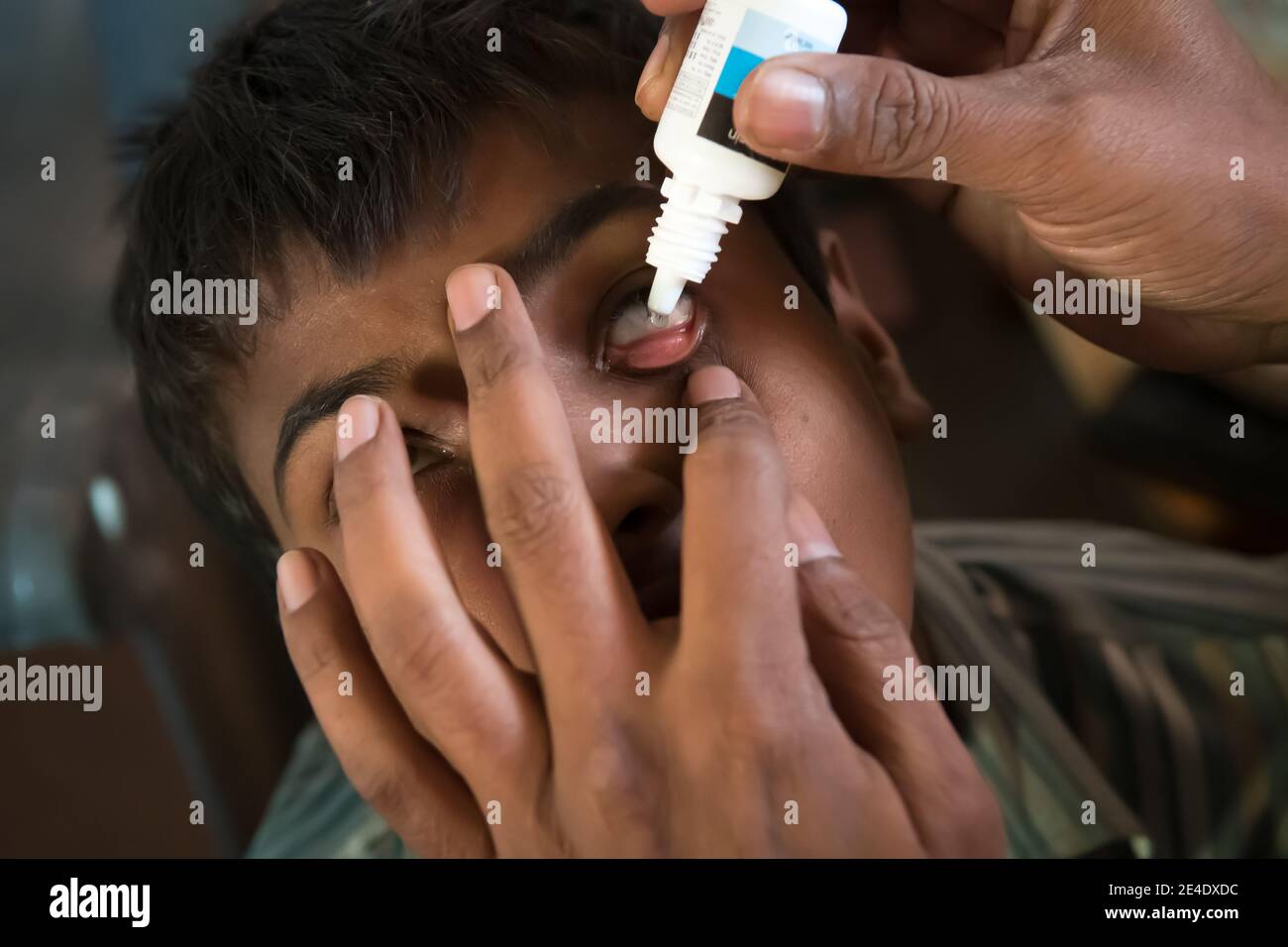 Rajasthan. India. 07-02-2018. Child receiving medical attention by doctor for a problem with his eyes. Stock Photo