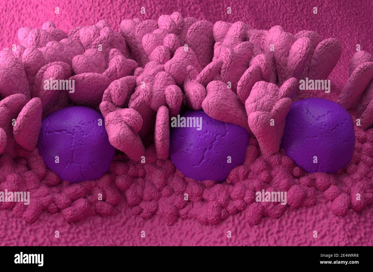 Peyer's Patches lymphoid-tissue in the human body part of the immune system 3d illustration isometric view Stock Photo