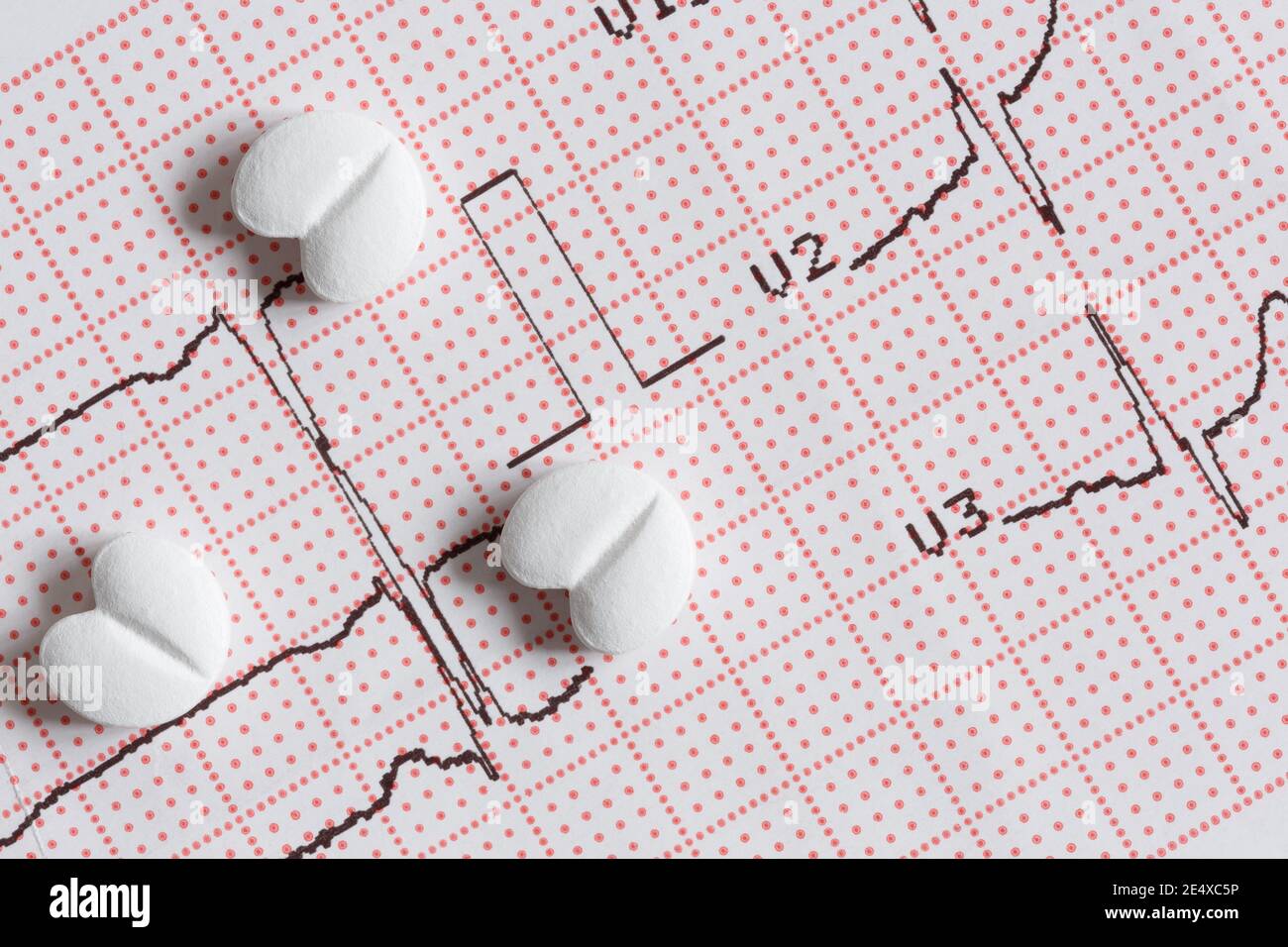 Electrocardiogram hi-res stock photography and images - Alamy