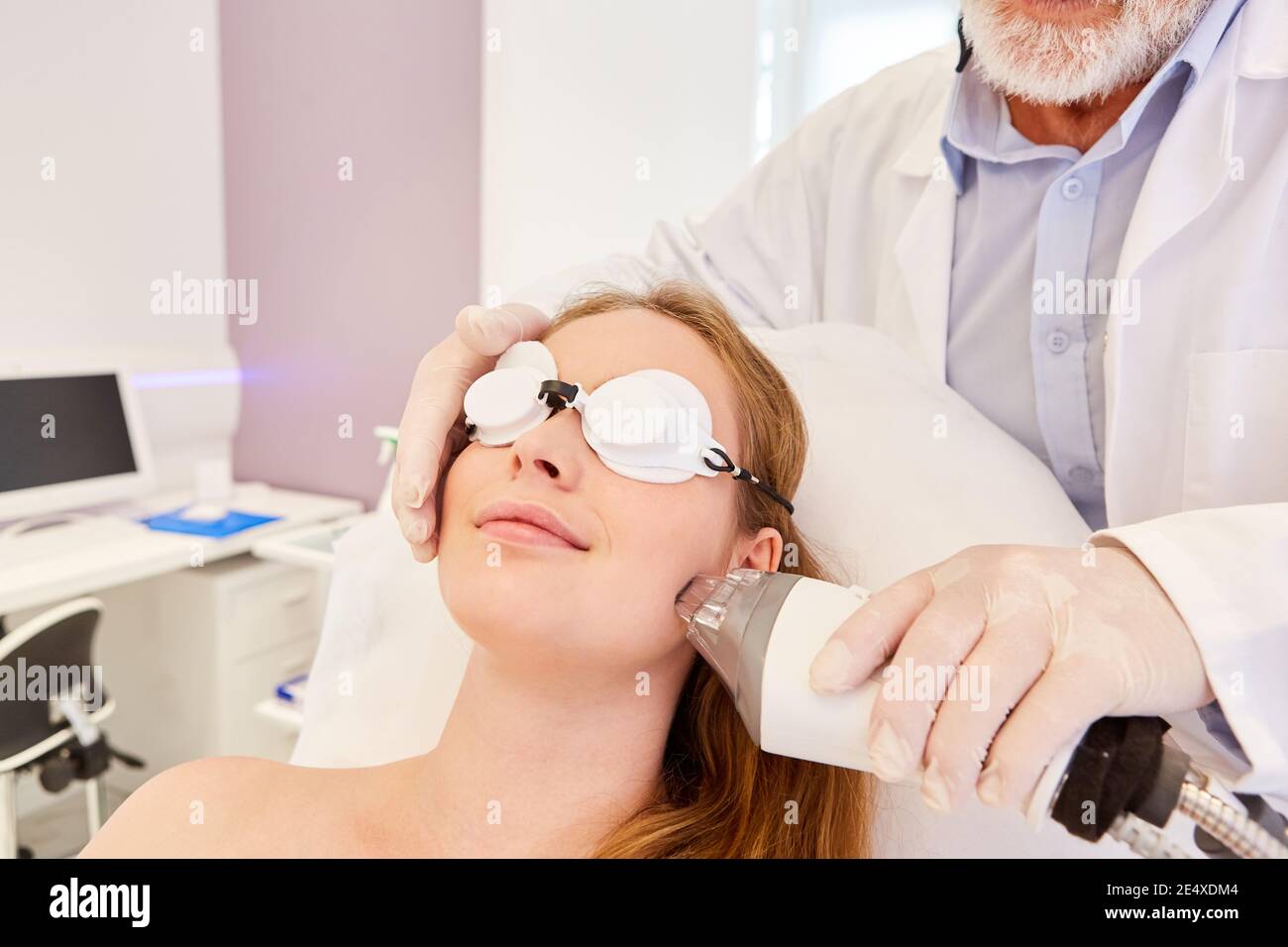 Skin rejuvenation and renewal of the skin by treatment with the Fraxel laser Stock Photo