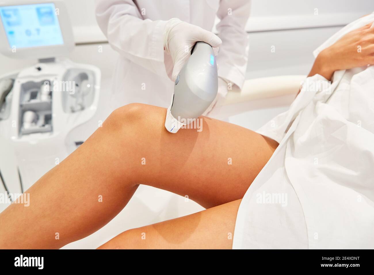 Dermatologist using Ultraformer to tighten the skin on the thigh to prevent stretch marks Stock Photo