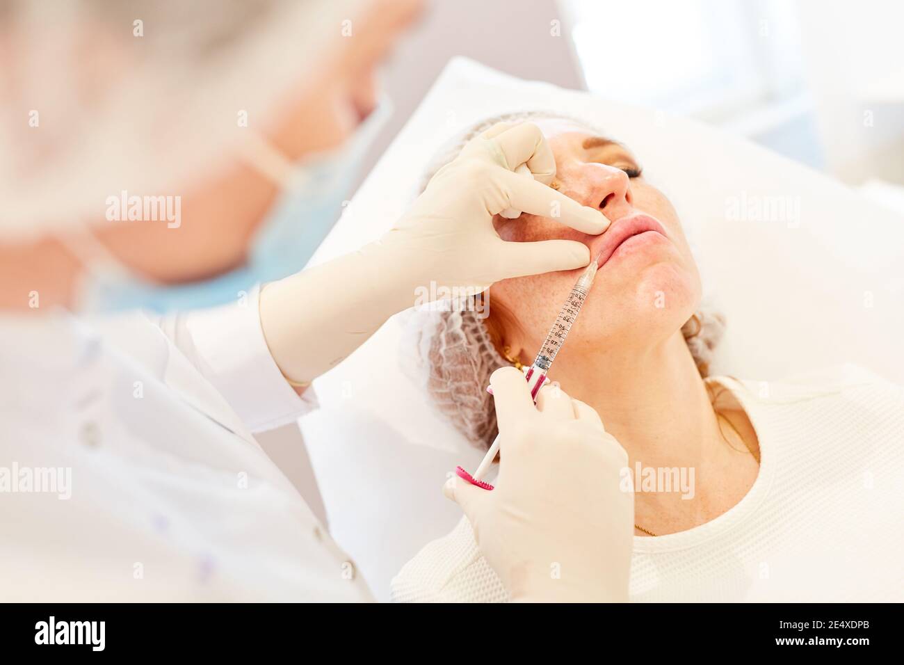 Dermatologist injecting lips for lip augmentation with hyaluronic acid at a specialist Stock Photo