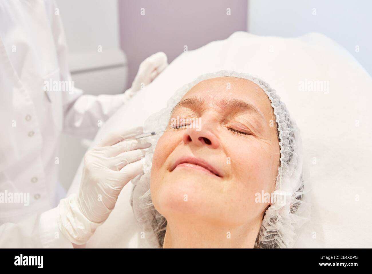 Doctor injects senior woman hyaluronic acid dermal filler against laugh lines and crow's feet Stock Photo