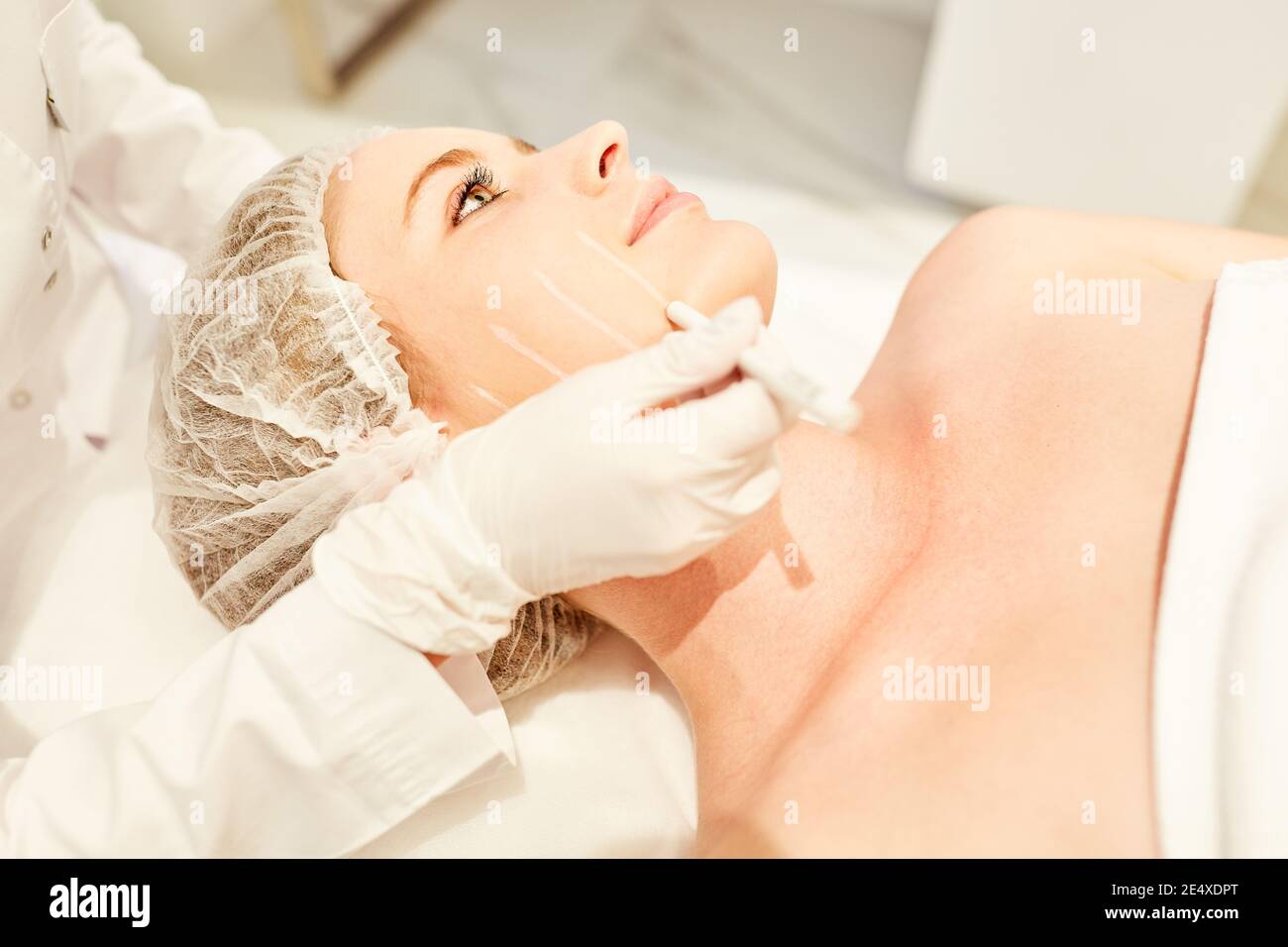 A patient's face is marked on the face for the facelift in the beauty clinic Stock Photo