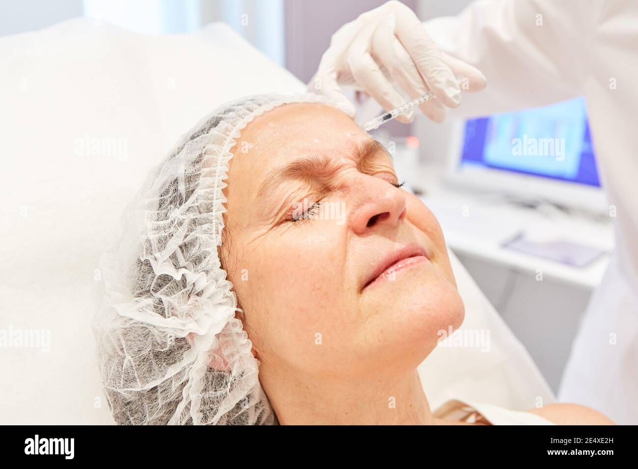 Elderly woman gets an injection with a hyaluronic acid dermal filler to reduce wrinkles on the