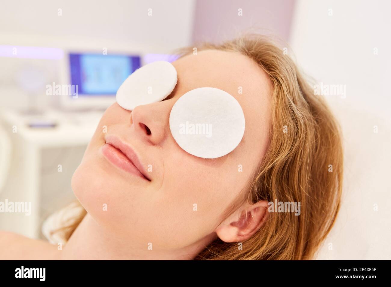 Cotton pads used as compresses on the eyes as a prevention against