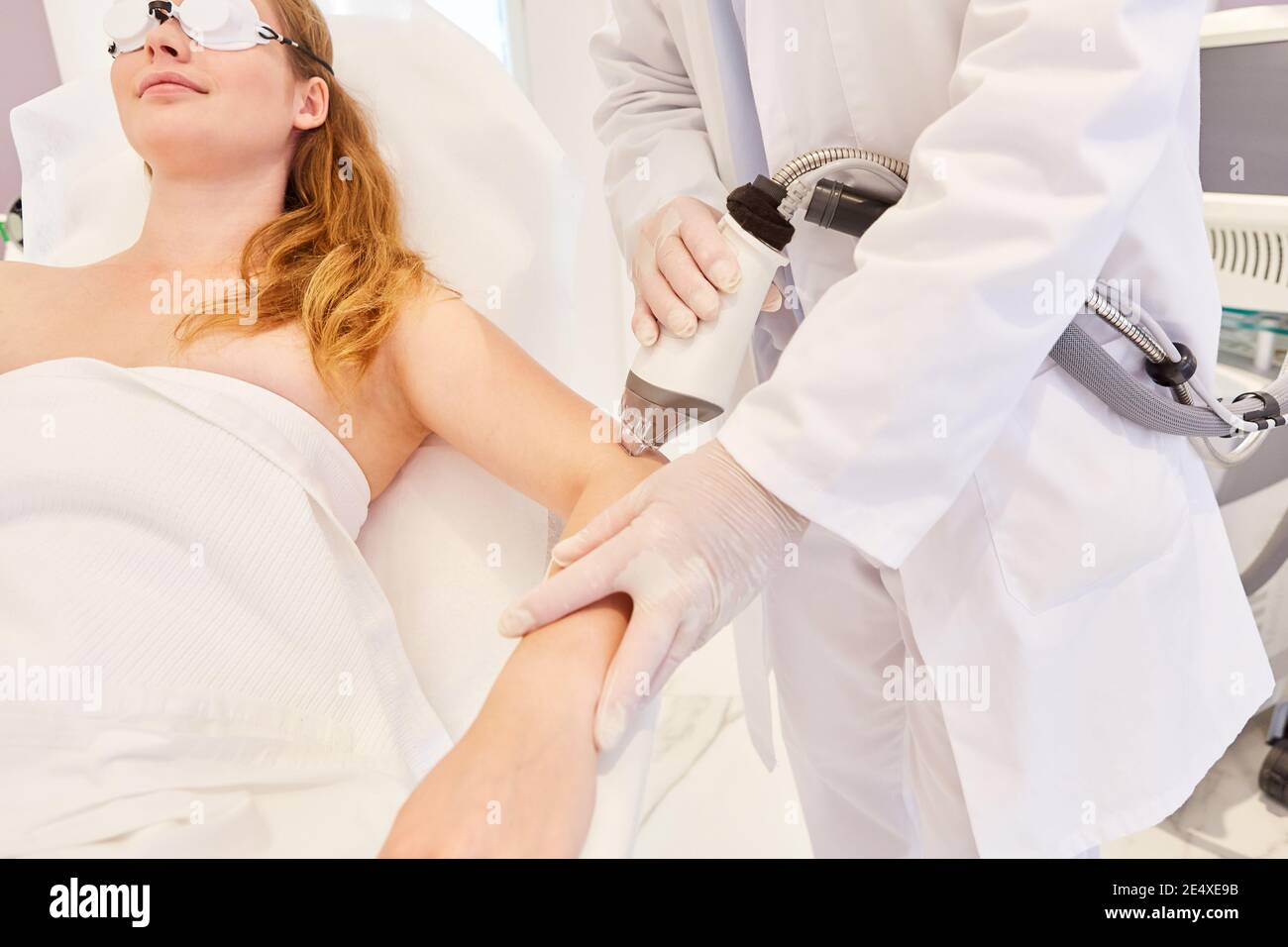 Skin tightening and rejuvenation of the upper arm through fractional photothermolysis Stock Photo