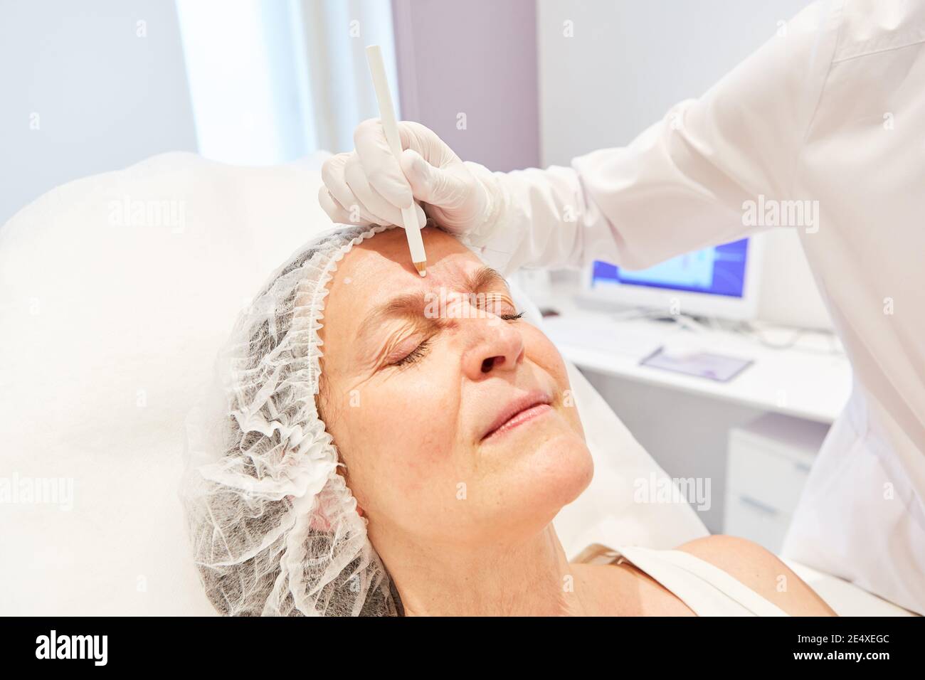 Preparation for a facelift with hyaluronic acid dermal filler in the beauty clinic Stock Photo