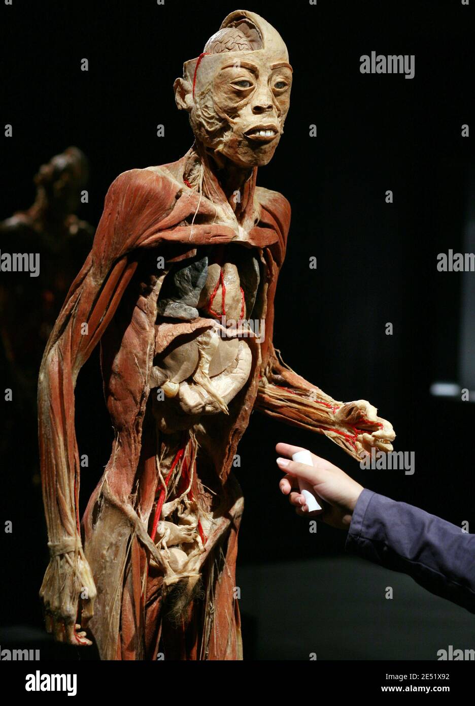 Our Body exhibition in Lyon, France on May 29, 2008. Consisting of actual  human bodies and organs this exhibit literally goes ""under the skin"",  revealing the mysteries of the human anatomy. The