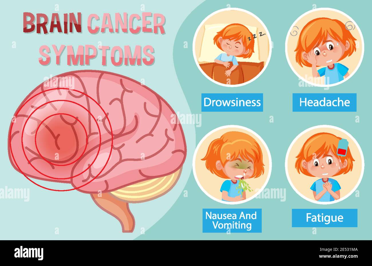 Information poster of human brain diagram illustration Stock Vector ...