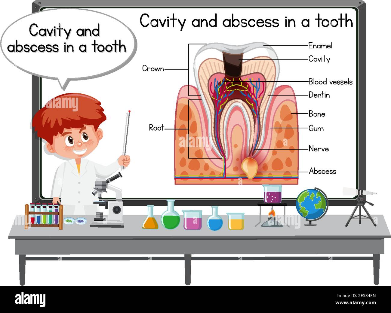 Young scientist explaining cavity and abscess in a tooth in laboratory