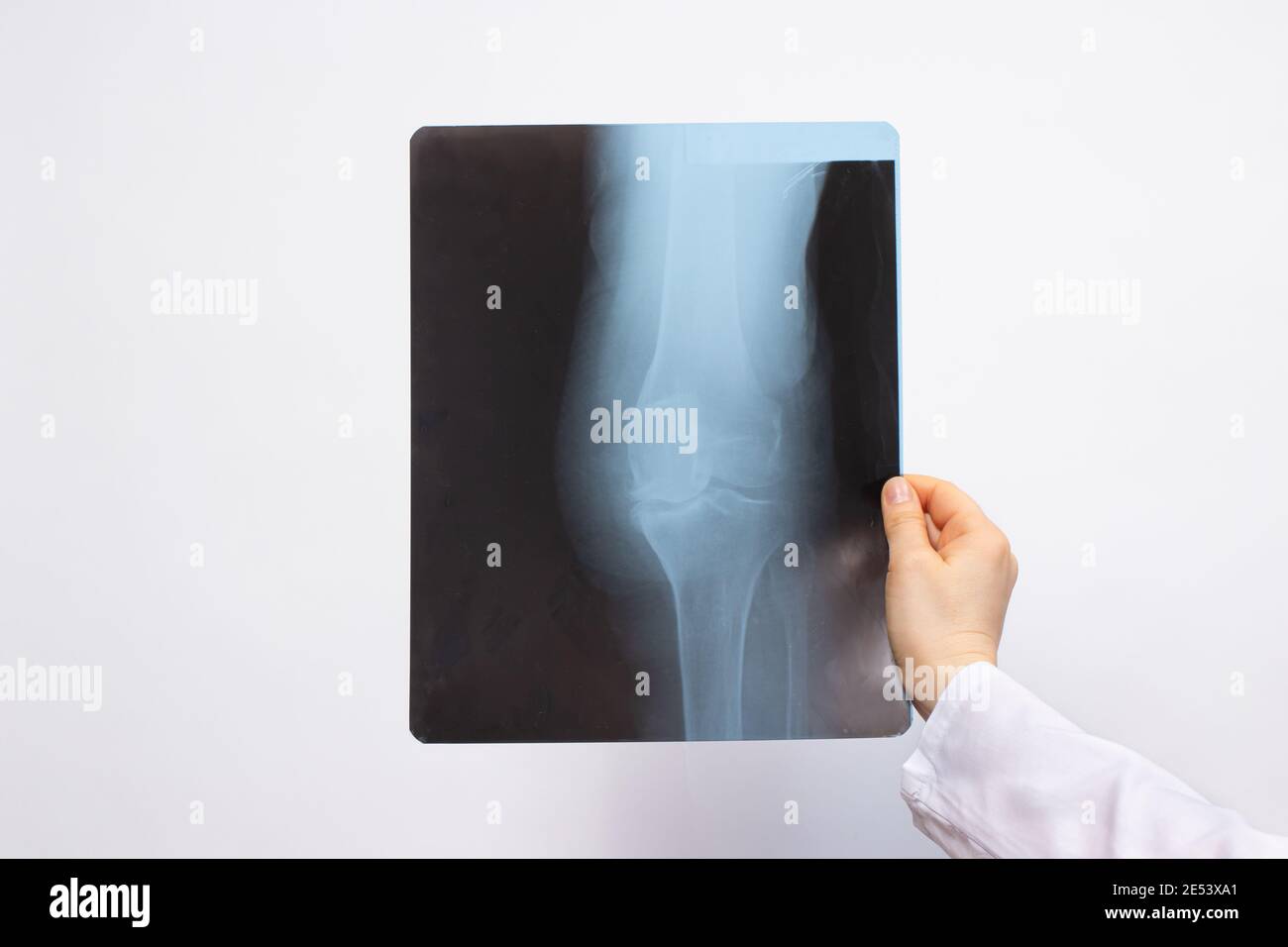 The doctor examines an X-ray of a patient with a knee injury on a white background with a place for text. Stock Photo