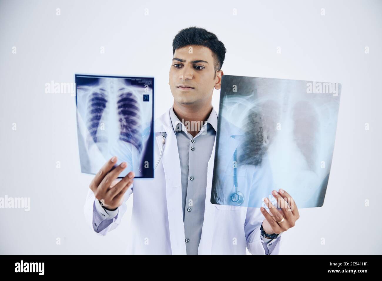 Serious young Indian doctor comparing two chest x-rays of patient, isolated on white Stock Photo