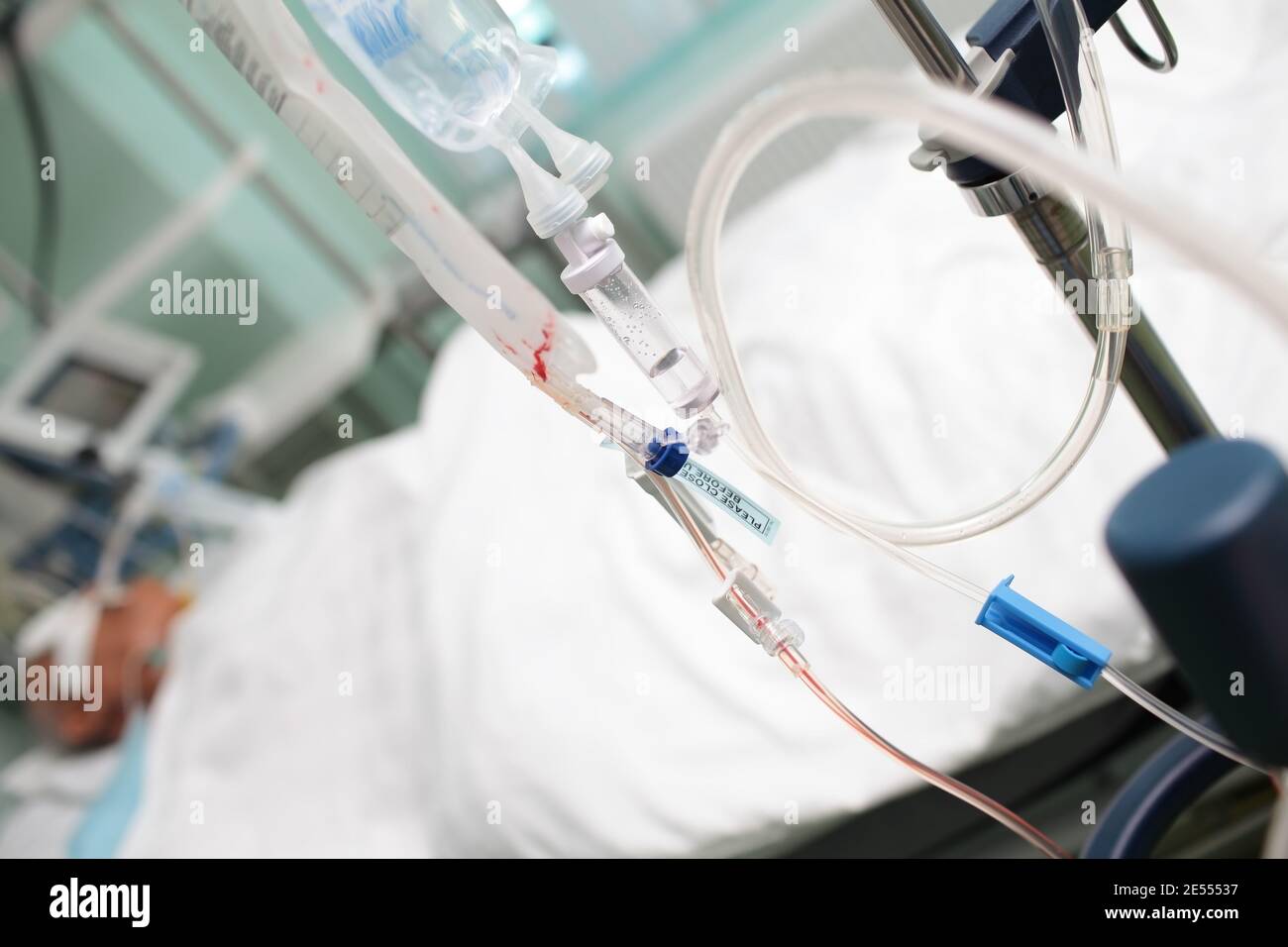 Blood transfusion to the unconscious patient. Stock Photo