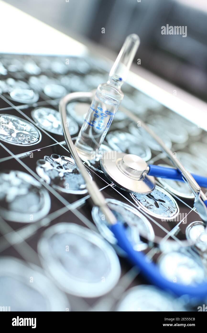 Treatment of an oncological diseases of human brain. Stock Photo
