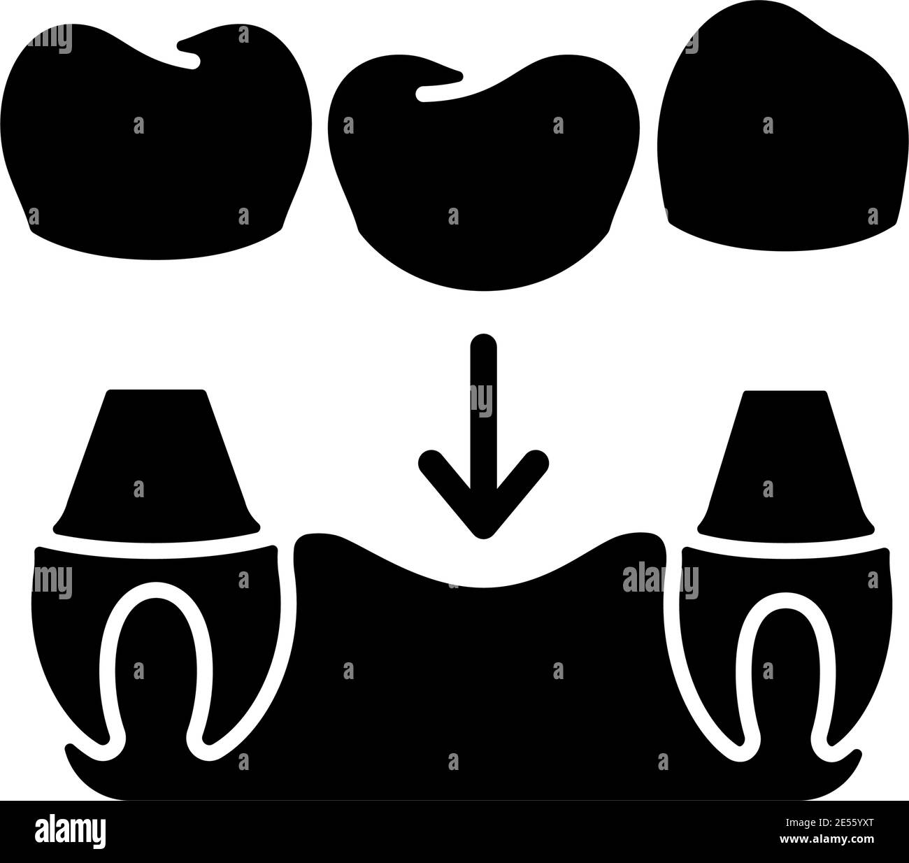 Dental prosthetics black glyph icon Stock Vector