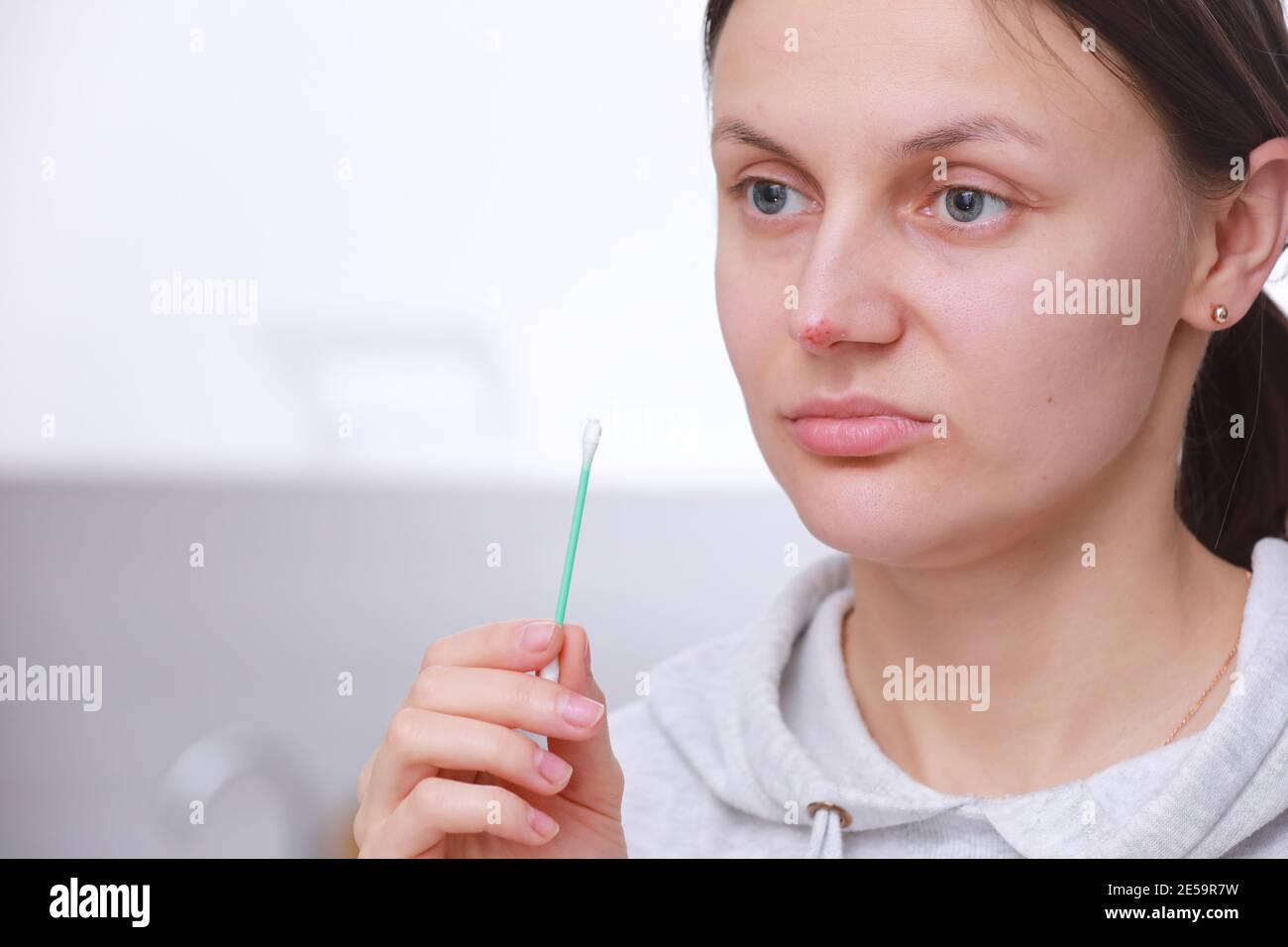 Herpes on the nose Pretty young woman woman holding an ear stick with