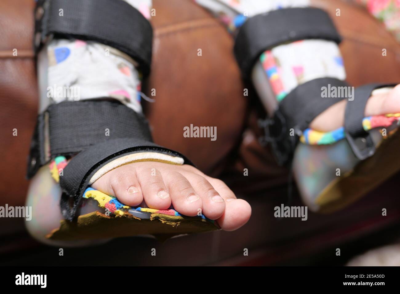 Child cerebral palsy disability, legs orthosis Stock Photo Alamy