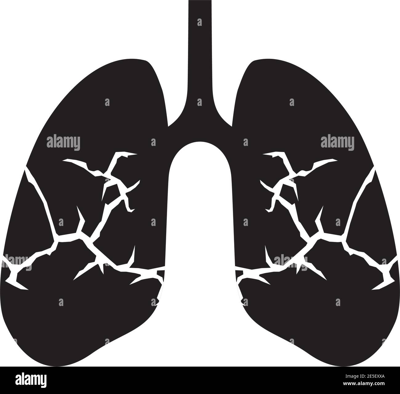 Lung medical logo design vector template Stock Vector