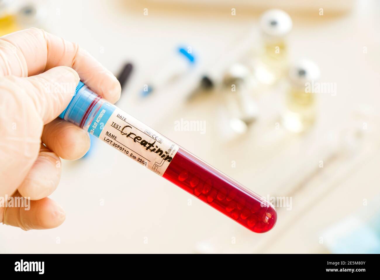 Tbilisi, January 27, 2021 Creatinine blood test tube sample