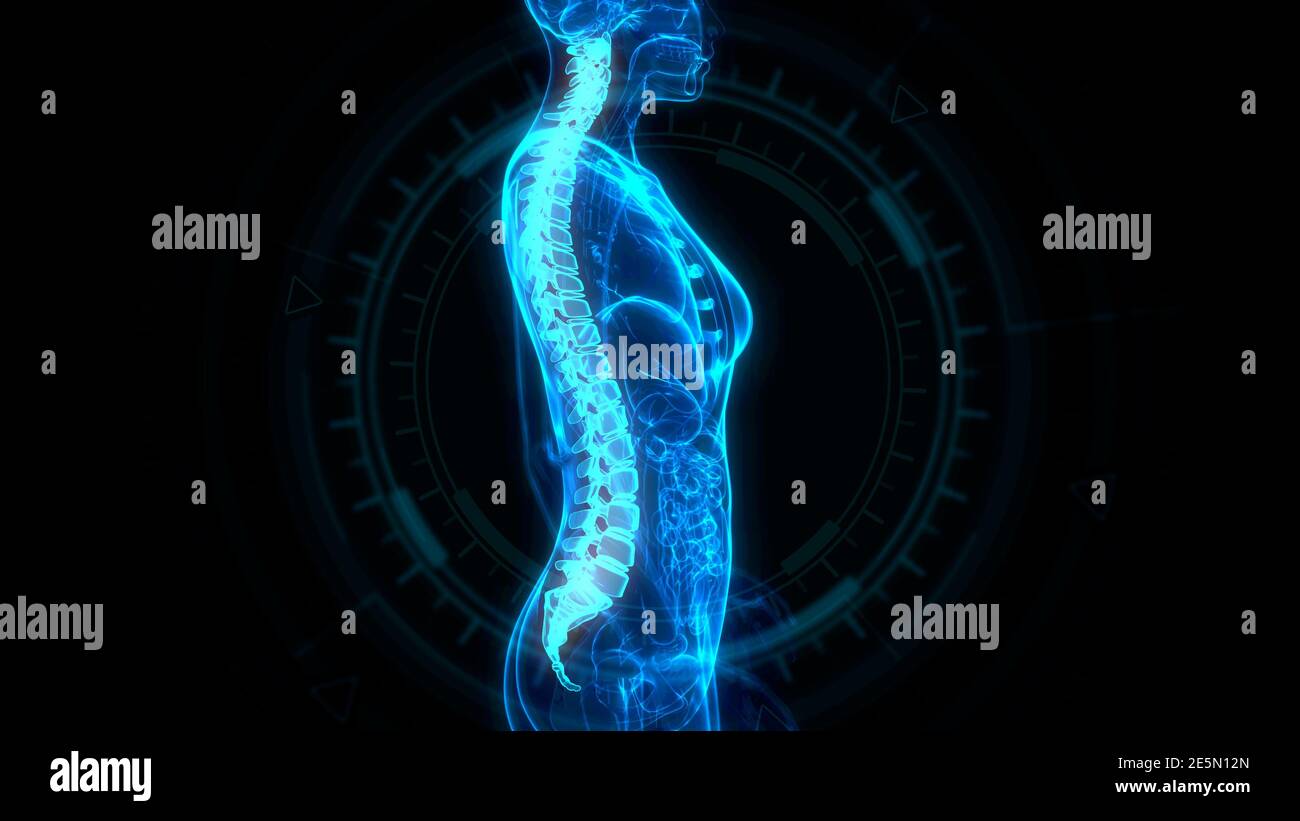 human spine on xray body, cg healthcare 3d illustration Stock Photo - Alamy