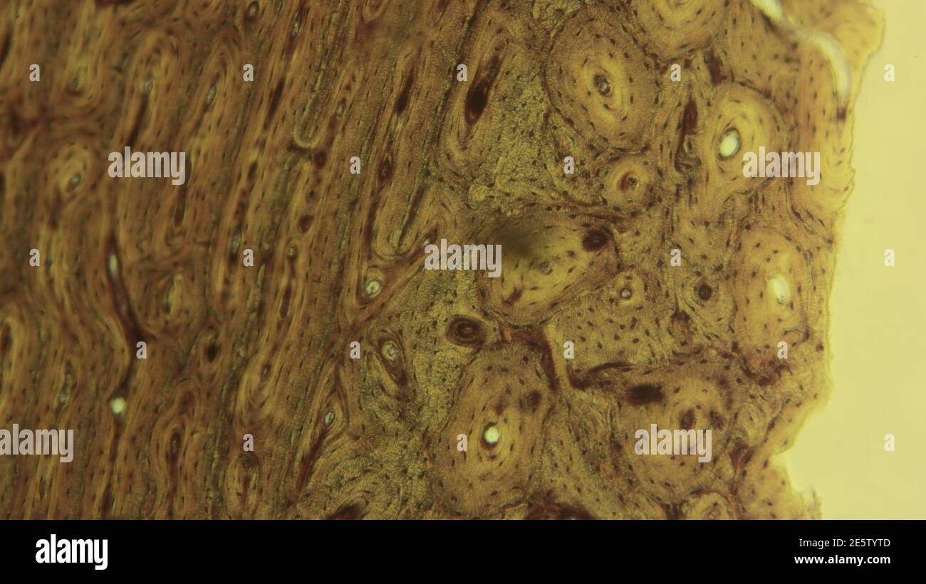 Compact Bone High Resolution Stock Photography And Images Alamy