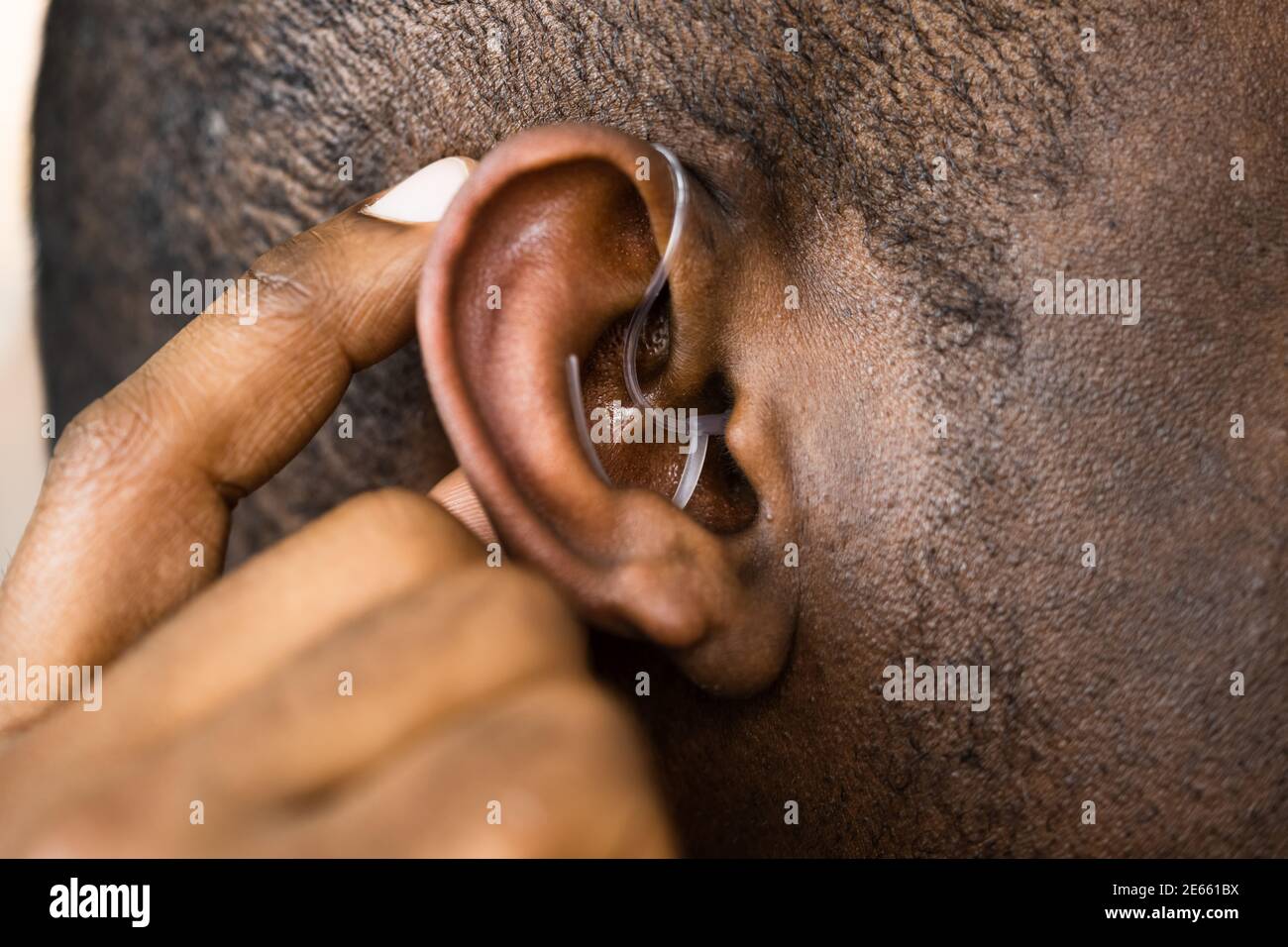 Hearing Aid And Audiology. Handicap And Disability Aid Stock Photo
