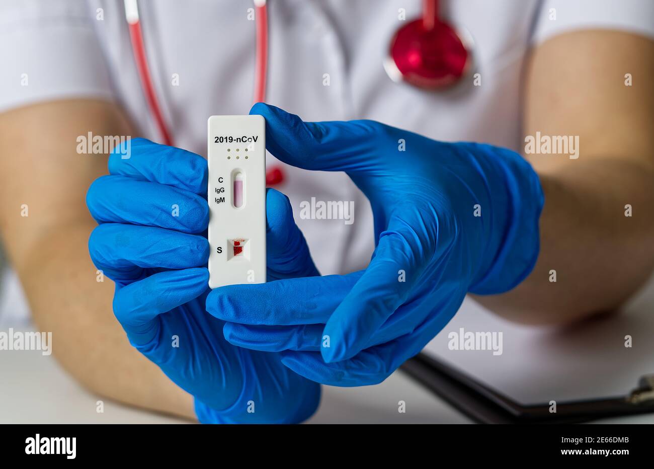 Antibody test hires stock photography and images Alamy