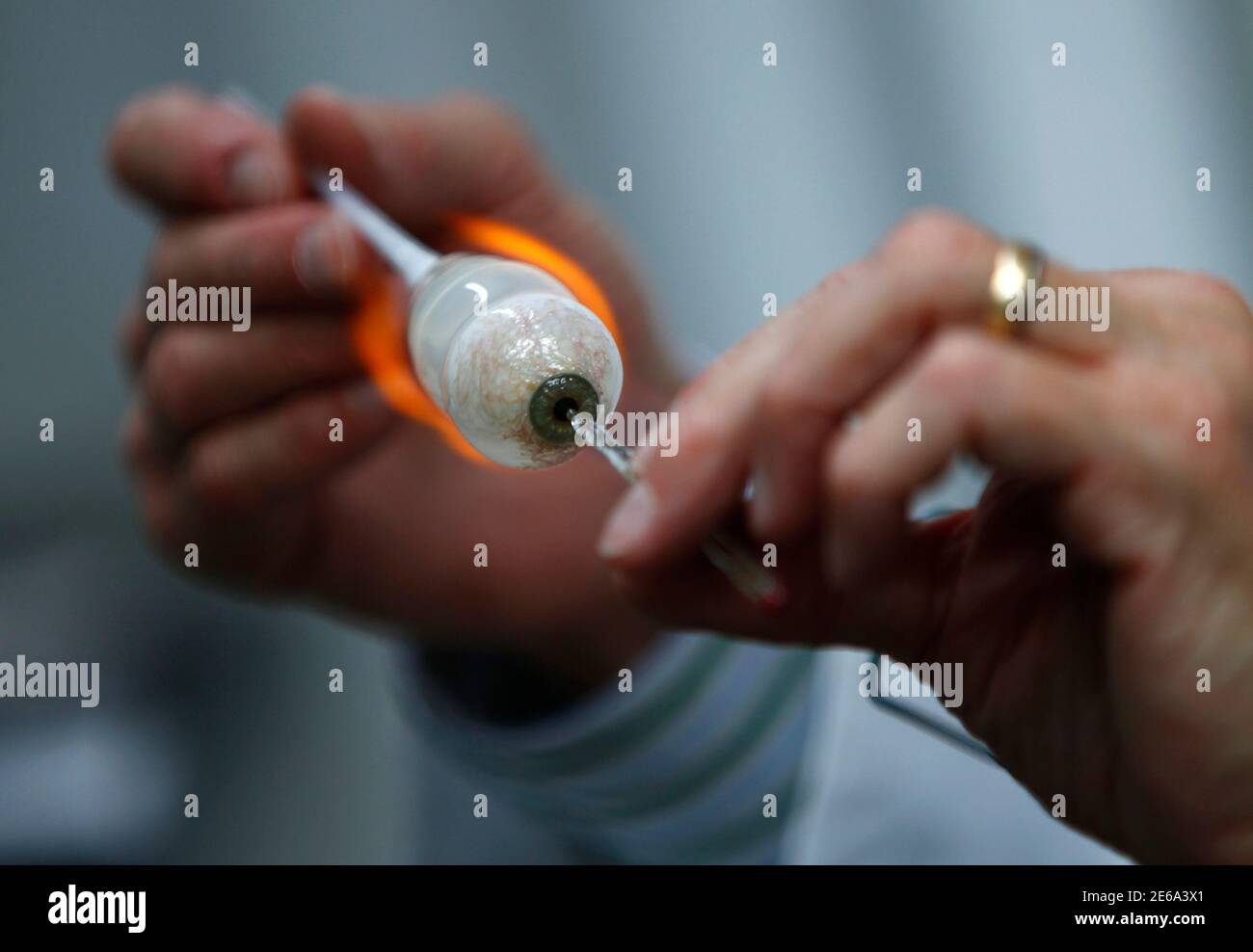 Trauma to the right eye hires stock photography and images Alamy