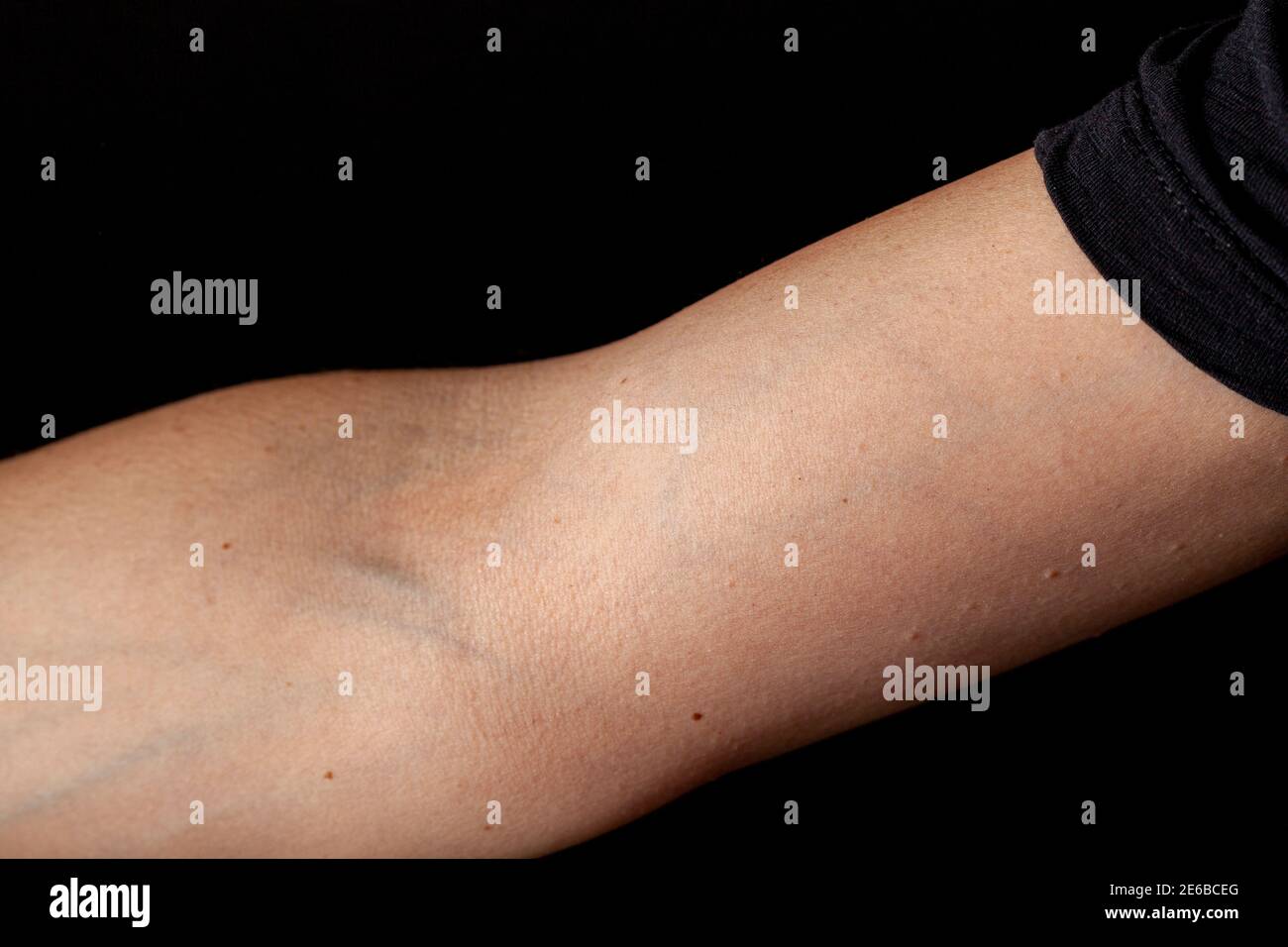 Close up image of a caucasian woman's elbow section (ventral side) with forearm extended and arm at lateral rotation. Background is black cephalic and Stock Photo