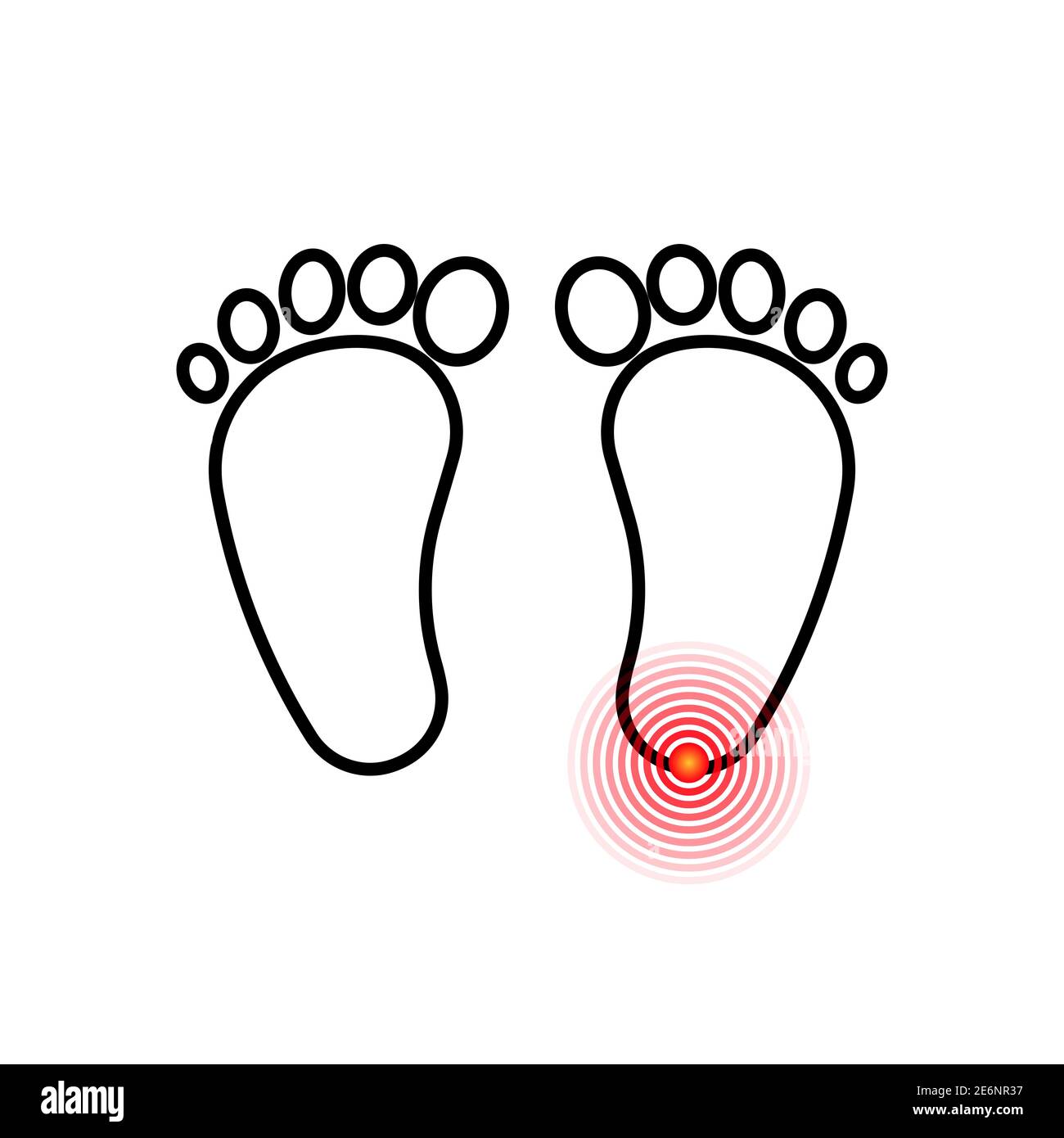 Foot pain icon. For biomechanics, footwear, shoe concepts, medical, health, massage, spa, acupuncture centers etc. Pain concept. Isolated on white bac Stock Vector