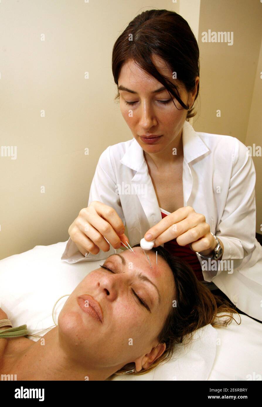 Facial acupuncture hi-res stock photography and images - Alamy