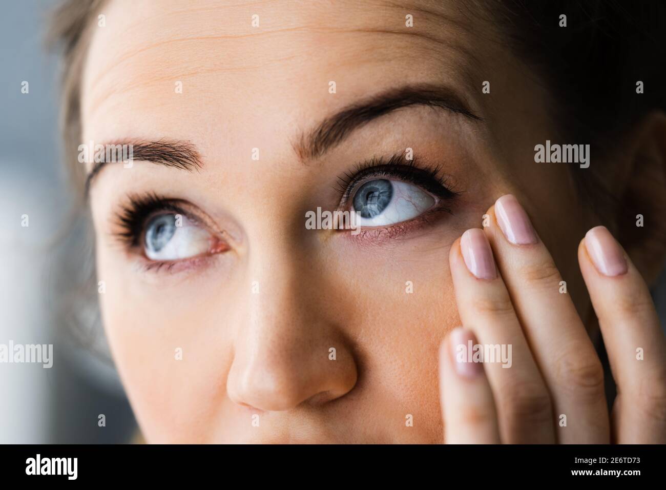 Tired Exhausted Eye Pain And Ache Problem Stock Photo