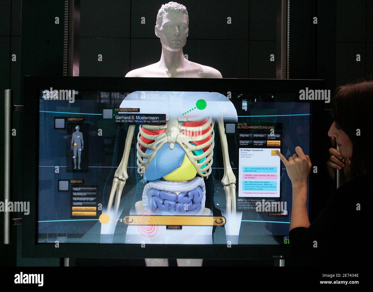 A Woman Presents An Anatomic Symbolic Mapper Engine Asme From Ibm Healthcare At The Ibm Exhibit At The Upcoming Cebit Fair In Hanover March 3 2008 According To Ibm The Technology Allows