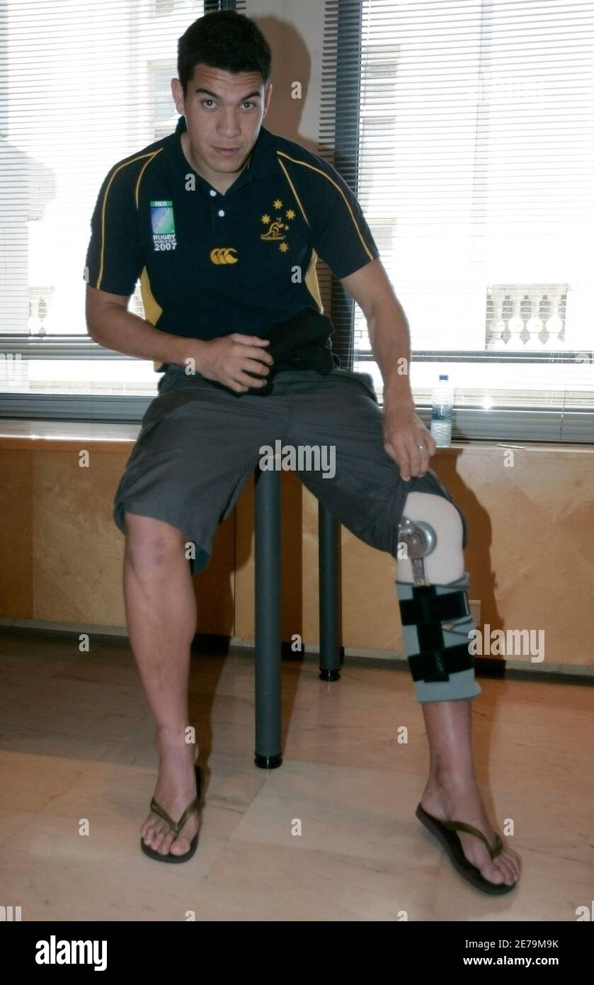Injured Australia's Rugby World Cup player Mark Gerrard displays his knee  cast before a news conference in Montpellier September 9, 2007.  REUTERS/Steve Holland (FRANCE Stock Photo - Alamy
