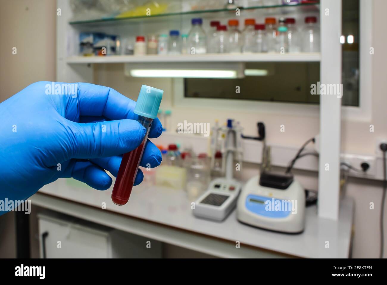 Laboratory blood test. Blood sample in hand against the background of
