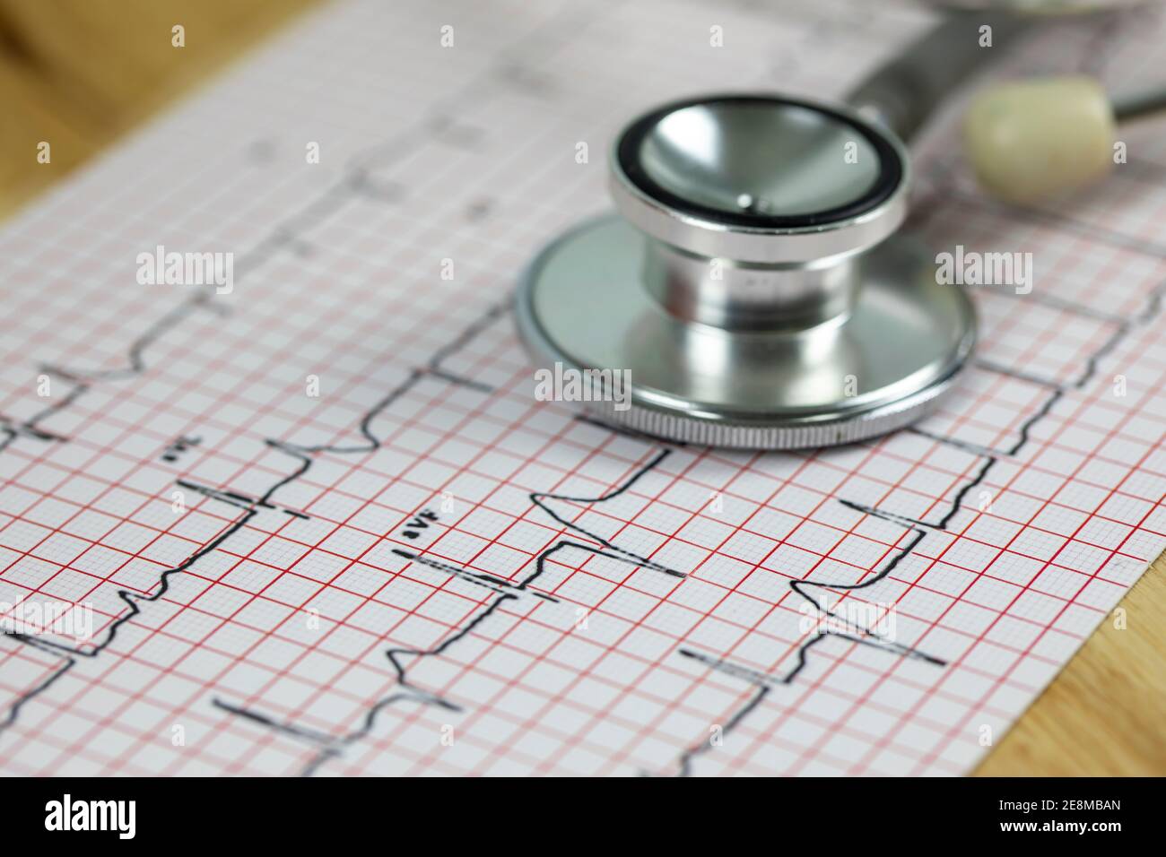 Ecg stress test hi-res stock photography and images - Alamy