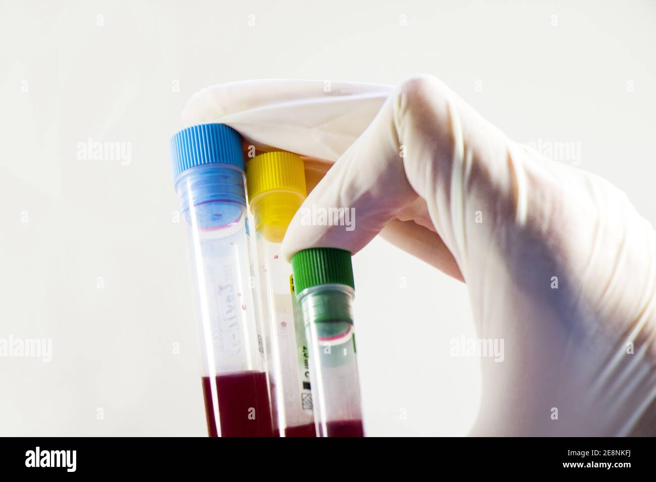 An isolated closeup of a hand in gloves holding blood test tubes on ...
