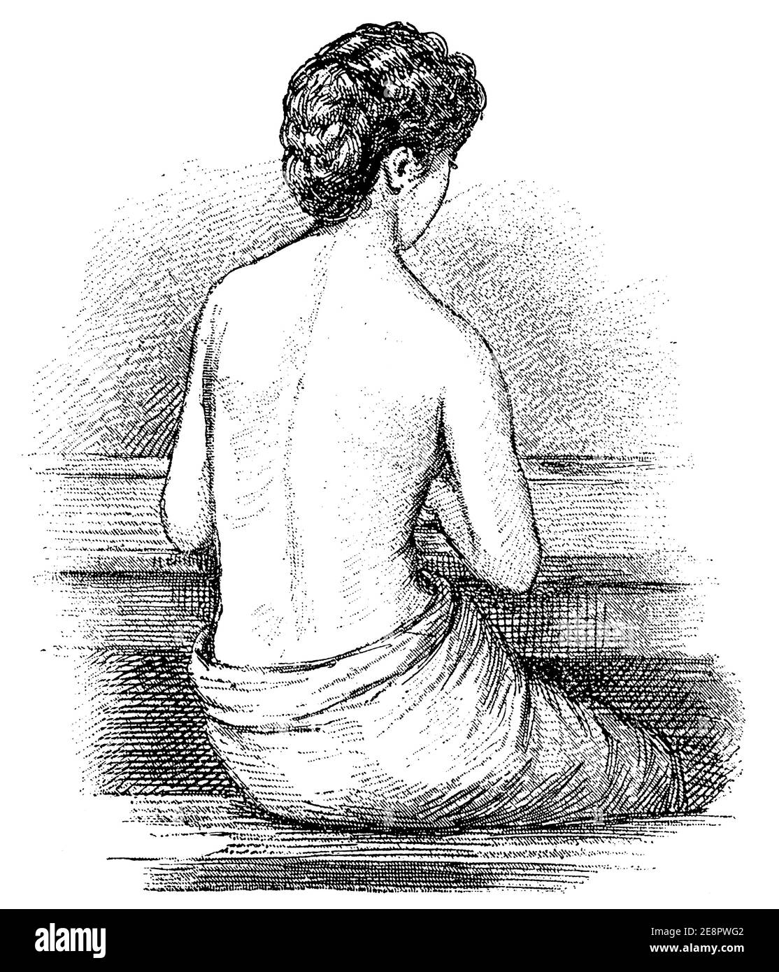 Elevation of the shoulder and curvature of the spine (scoliosis) due to poor posture at school. Illustration of the 19th century. Germany. White background. Stock Photo