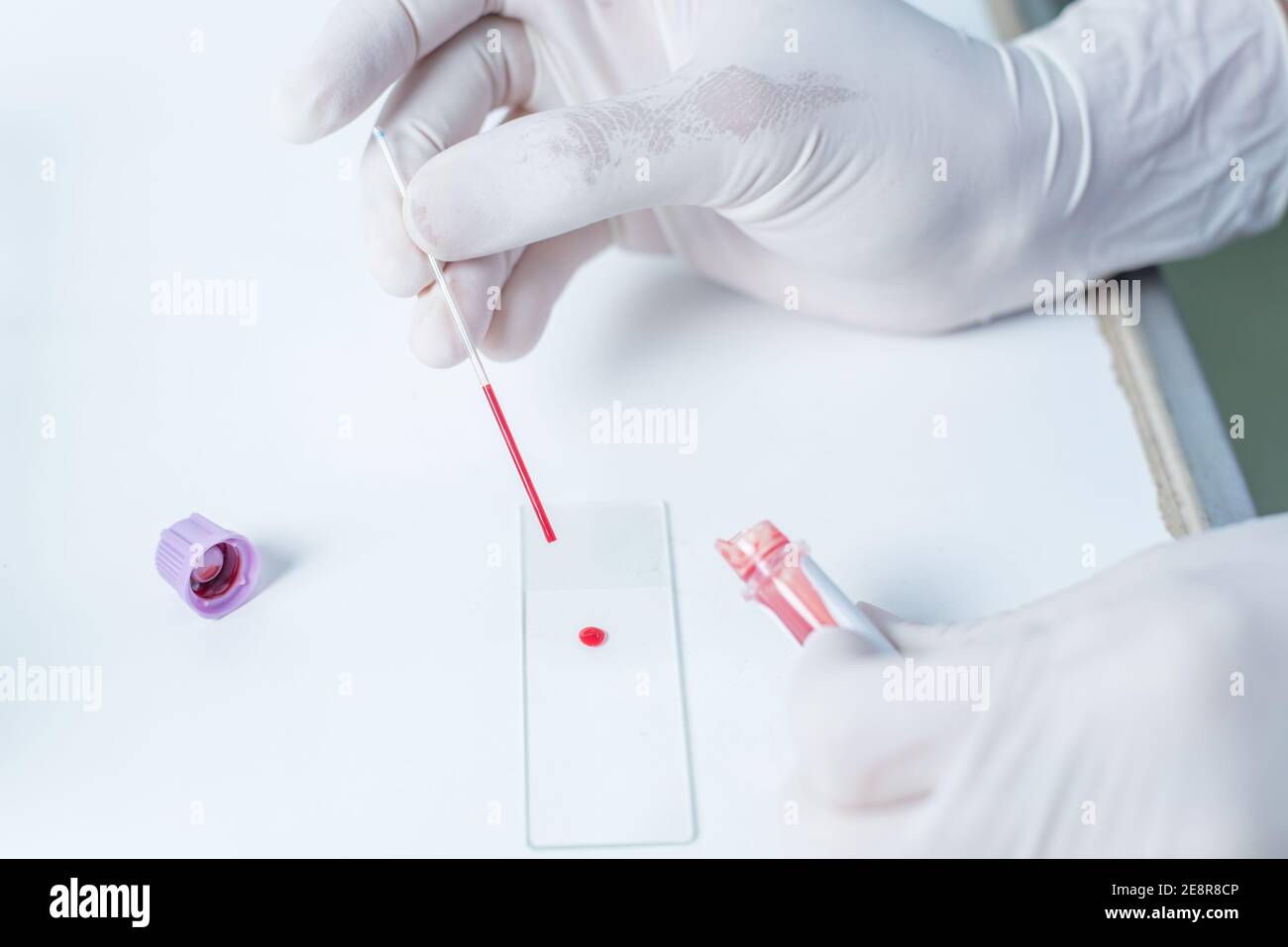 Blood sampling with needle for analysis in laboratory Stock Photo Alamy