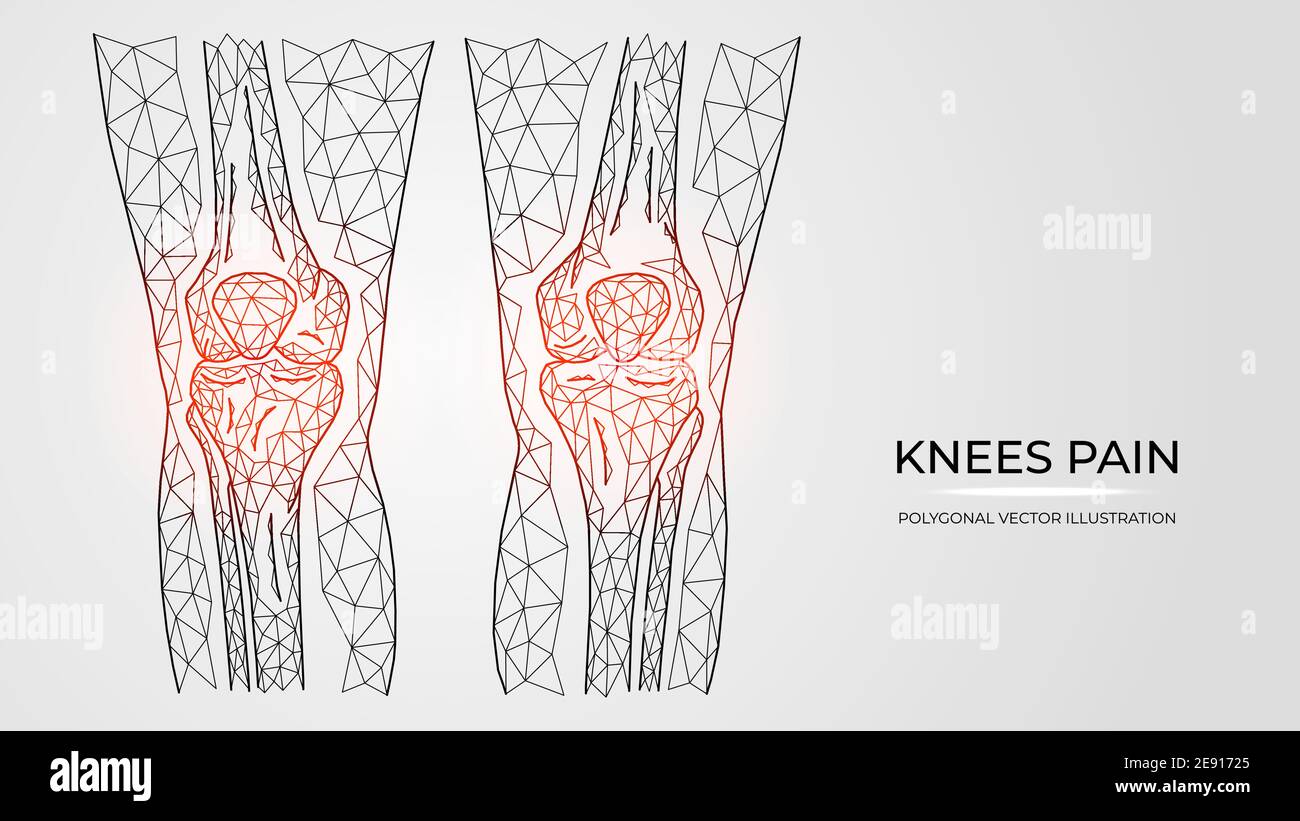 Polygonal vector illustration of pain, inflammation or injury in knees. Human legs bones anatomy