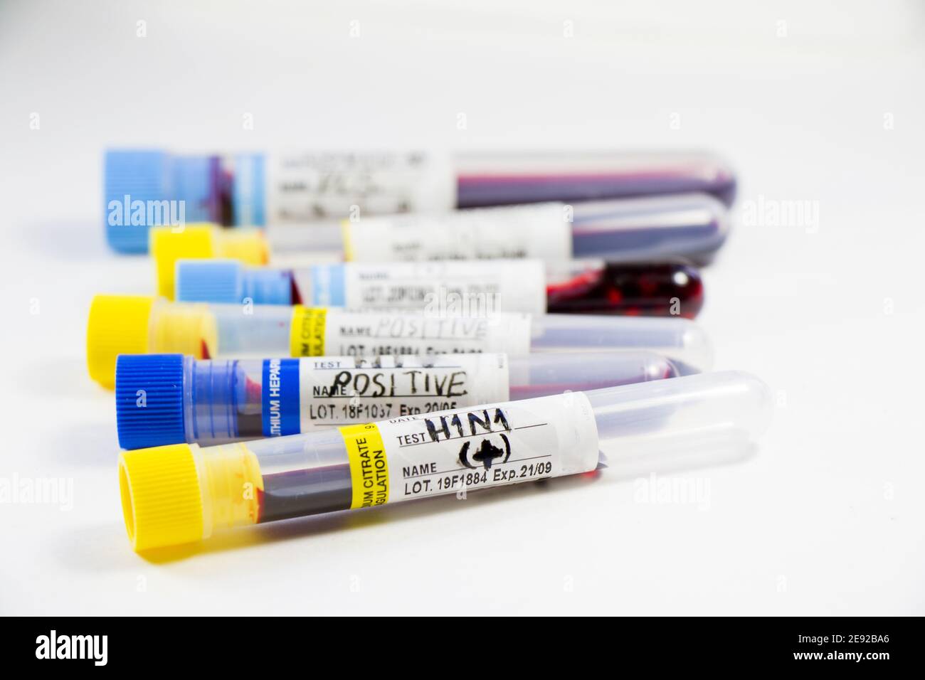 Closeup shot of different blood specimen on test tubes against white ...