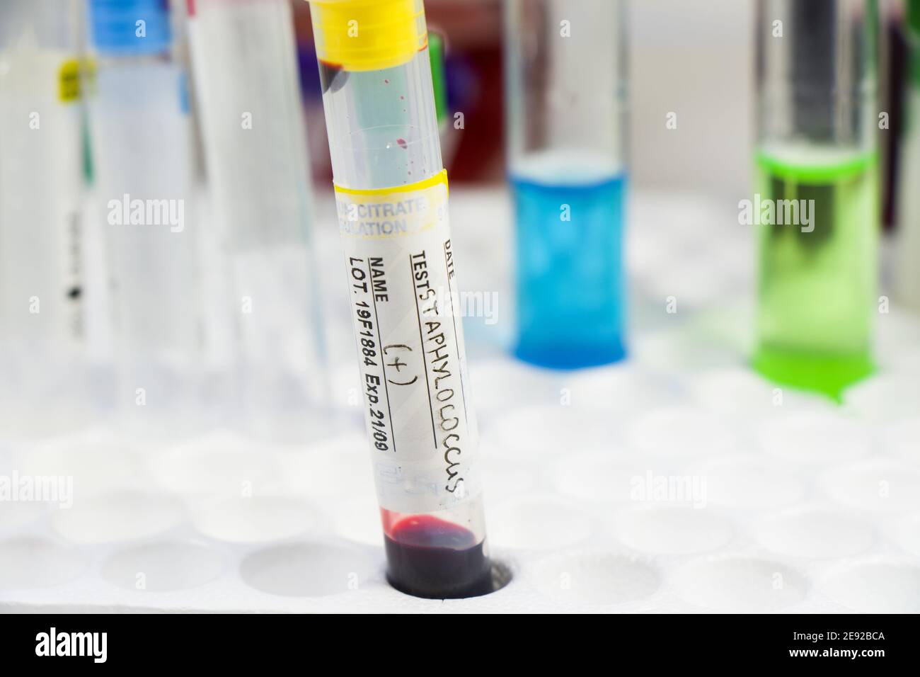 Closeup shot of positive staphylococcus blood specimen on test tube