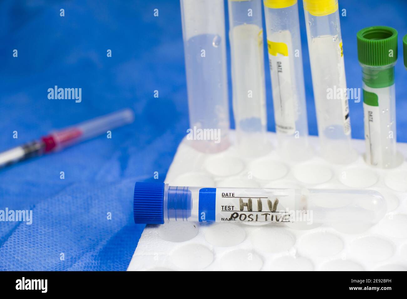 High angle of an empty positive HIV test tube in the laboratory Stock